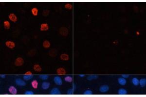 Immunofluorescence analysis of HeLa cells using Phospho-γH2A. (gamma H2AX Antikörper  (pSer139))