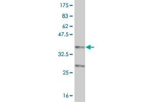 Western Blotting (WB) image for anti-Nuclear Receptor Subfamily 4, Group A, Member 2 (NR4A2) (AA 147-250) antibody (ABIN518480)