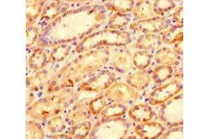 Immunohistochemistry of paraffin-embedded human kidney tissue using ABIN7177041 at dilution of 1:100 (CXCL11 Antikörper  (AA 22-98))