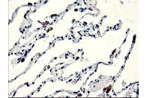 Immunohistochemical staining of paraffin-embedded Human lung tissue using anti-CENPH mouse monoclonal antibody. (CENPH Antikörper)