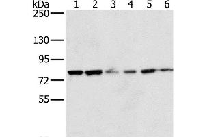 Western Blot analysis of 293T and hela cell, Human testis tissue, skov3, Raji and Jurkat cell using NOX5 Polyclonal Antibody at dilution of 1:200 (NOX5 Antikörper)