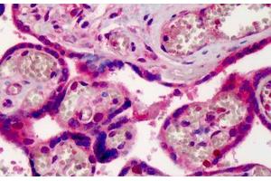 Human Placenta: Formalin-Fixed, Paraffin-Embedded (FFPE) (XPO1 Antikörper  (AA 390-408))