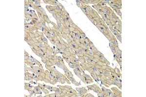 Immunohistochemistry of paraffin-embedded rat heart using SGCD antibody. (SGCD Antikörper  (AA 61-290))