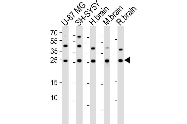 STMN2 antibody  (N-Term)
