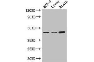 Western Blot Positive WB detected in: MCF-7 whole cell lysate, Mouse liver tissue, Mouse brain tissue All lanes: KCNJ11 antibody at 3 μg/mL Secondary Goat polyclonal to rabbit IgG at 1/50000 dilution Predicted band size: 44, 34 kDa Observed band size: 44 kDa (KCNJ11 Antikörper  (AA 172-390))