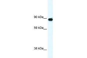 WB Suggested Anti-GRM6 Antibody Titration:  0. (Metabotropic Glutamate Receptor 6 Antikörper  (C-Term))