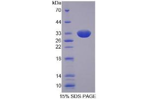 SDS-PAGE analysis of Human SLC22A11 Protein. (SLC22A11 Protein)