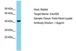 Image no. 1 for anti-Chromosome 4 Open Reading Frame 29 (C4ORF29) (AA 122-171) antibody (ABIN6750689) (C4ORF29 Antikörper  (AA 122-171))