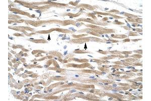 KIFC2 antibody was used for immunohistochemistry at a concentration of 4-8 ug/ml to stain Skeletal muscle cells (lndicated with Arrows) in Human Muscle.
