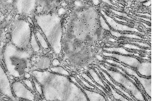 Immunoelectron Microscopy (IEM) image for anti-Heat Shock 60kDa Protein 1 (Chaperonin) (HSPD1) antibody (ABIN7074167)