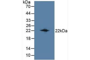 Detection of LCN8 in Mouse Testis Tissue using Polyclonal Antibody to Lipocalin 8 (LCN8) (LCN8 Antikörper  (AA 27-176))