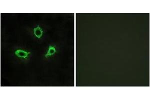 Immunofluorescence analysis of LOVO cells, using GPR115 Antibody.