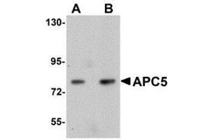 Western blot analysis of APC5 in human kidney tissue lysate with AP30061PU-N APC5 antibody at (A) 1 and (B) 2 μg/ml. (ANAPC5 Antikörper  (Center))