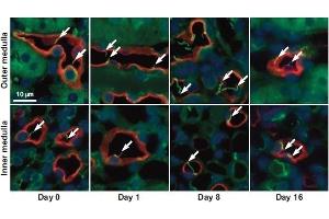 Expression of Aquaporin 1 in mouse kidneyImmunohistochemical staining of mouse kidney sections using Anti-Aquaporin 1 Antibody (ABIN7042932, ABIN7045194 and ABIN7045195).