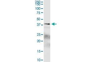 SPDEF polyclonal antibody (A01). (SPDEF/PSE Antikörper  (AA 1-335))
