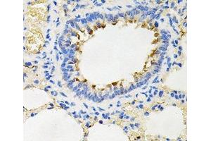 Immunohistochemistry of paraffin-embedded Rat lung using IRAK2 Polyclonal Antibody at dilution of 1:100 (40x lens).