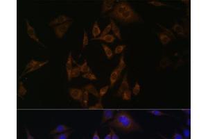 Immunofluorescence analysis of HeLa cells using UBE2L6 Polyclonal Antibody at dilution of 1:100. (UBE2L6 Antikörper)