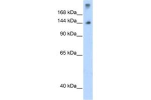 Western Blotting (WB) image for anti-Splicing Factor 3b, Subunit 1, 155kDa (SF3B1) antibody (ABIN2462069) (SF3B1 Antikörper)