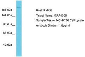 Image no. 1 for anti-KIAA0556 (KIAA0556) (AA 142-191) antibody (ABIN6750570) (KIAA0556 Antikörper  (AA 142-191))