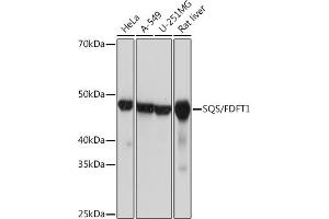 Western blot analysis of extracts of various cell lines, using SQS/FDFT1 Rabbit mAb (ABIN7267130) at 1:1000 dilution. (FDFT1 Antikörper)