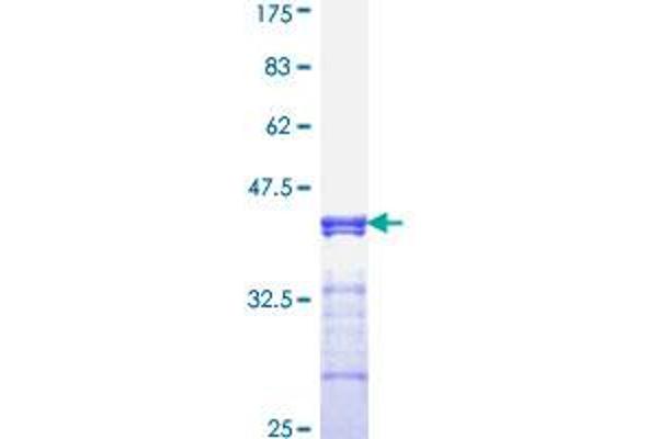 TCF7L2 Protein (AA 490-596) (GST tag)