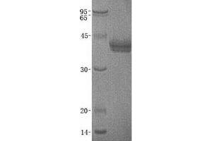 Validation with Western Blot (CADM3 Protein (Transcript Variant 2) (His tag))