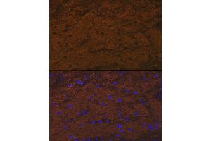 Immunofluorescence analysis of rat brain cells using TMOD2 Rabbit mAb (ABIN7271011) at dilution of 1:100 (40x lens). (TMOD2 Antikörper)
