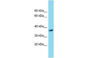 Western Blotting (WB) image for anti-Sideroflexin 5 (SFXN5) (N-Term) antibody (ABIN2774474) (Sideroflexin 5 Antikörper  (N-Term))
