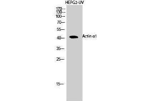 Western Blotting (WB) image for anti-Actin, alpha 1, Skeletal Muscle (ACTA1) (N-Term) antibody (ABIN3183158) (Actin Antikörper  (N-Term))