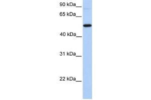 Western Blotting (WB) image for anti-UDP-N-Acetyl-alpha-D-Galactosamine:polypeptide N-Acetylgalactosaminyltransferase 13 (GalNAc-T13) (GALNT13) antibody (ABIN2459376)