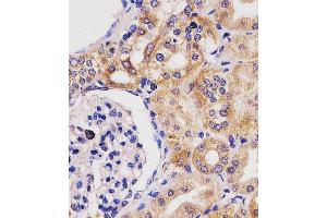 (ABIN6243842 and ABIN6577230) staining GLS2 in human kidney tissue sections by Immunohistochemistry (IHC-P - paraformaldehyde-fixed, paraffin-embedded sections). (GLS2 Antikörper)