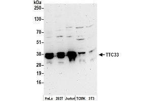 anti-Tetratricopeptide Repeat Domain 33 (TTC33) (AA 212-262) antibody