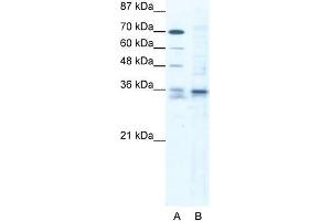 Human Jurkat; WB Suggested Anti-SOX12 Antibody. (SOX12 Antikörper  (C-Term))