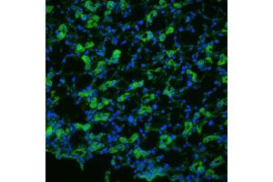 Immunohistochemistry analysis using Rabbit Anti-Aquaporin 1 Polyclonal Antibody . (Aquaporin 1 Antikörper  (N-Term) (Biotin))