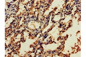 Immunohistochemistry of paraffin-embedded human lung tissue using ABIN7161677 at dilution of 1:100 (NOG Antikörper  (AA 28-232))