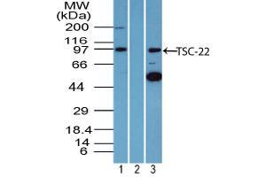Image no. 1 for anti-TSC22 Domain Family, Member 1 (TSC22D1) (AA 100-150) antibody (ABIN960389) (TSC22D1 Antikörper  (AA 100-150))