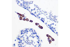Immunohistochemistry of paraffin-embedded mouse testis using [KO Validated] Bax Rabbit mAb (ABIN7265855) at dilution of 1:100 (40x lens). (BAX Antikörper)