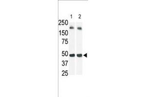 The anti-SphK1 Pab (ABIN391345 and ABIN2841366) is used in Western blot (Lane 2) to detect c-myc-tagged SphK1 in transfected 293 cell lysate (a c-myc antibody is used as control in Lane 1). (SPHK1 Antikörper  (N-Term))
