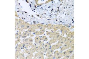 Immunohistochemistry of paraffin-embedded human liver injury using LETMD1 antibody (ABIN5971174) at dilution of 1/100 (40x lens).