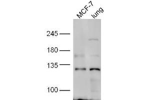 line1, MCF-7 lysate; line2,mouse lung lysate probed with Rabbit Anti-HNRPUL1 Polyclonal Antibody, Unconjugated  at 1:5000 for 90min at 37˚C.