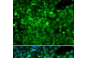 Immunofluorescence analysis of A549 cells using POC1A Polyclonal Antibody (POC1A Antikörper)