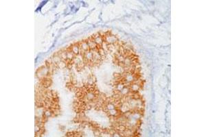 Immunohistochemistry (IHC) image for anti-Phosphotyrosine antibody (ABIN197635) (Phosphotyrosine Antikörper)