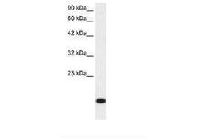 Image no. 1 for anti-Ribosomal Protein S16 (RPS16) (N-Term) antibody (ABIN202031) (RPS16 Antikörper  (N-Term))