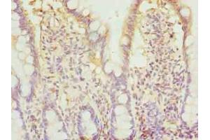Immunohistochemistry of paraffin-embedded human small intestine tissue using ABIN7145881 at dilution of 1:100 (BTN2A2 Antikörper  (AA 33-262))