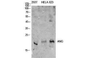 Western Blotting (WB) image for anti-Angiotensinogen (serpin Peptidase Inhibitor, Clade A, Member 8) (AGT) (Internal Region) antibody (ABIN3178889) (AGT Antikörper  (Internal Region))