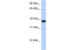WB Suggested Anti-ASB5 Antibody Titration:  0. (ASB5 Antikörper  (C-Term))