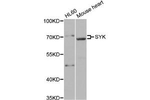 Western blot analysis of extracts of various cell lines, using SYK antibody (ABIN5971150) at 1/500 dilution.