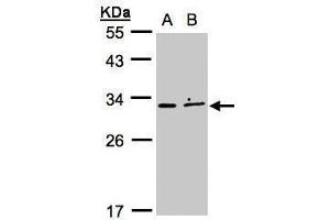 WB Image Sample (30μg whole cell lysate) A:MOLT4 , B:Raji , 12% SDS PAGE antibody diluted at 1:500 (XRCC2 Antikörper)