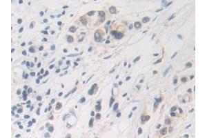 Immunohistochemistry (IHC) image for anti-Farnesyl-Diphosphate Farnesyltransferase 1 (FDFT1) (AA 269-417) antibody (ABIN7433993)