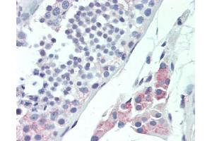 Human Testis: Formalin-Fixed, Paraffin-Embedded (FFPE), at a dilution of 1:100. (MLF1 Antikörper  (AA 215-244))